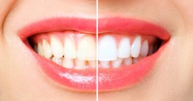 Tandblekning hemma: Guide till Strålande Vita Tänder